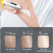 Silk Touch Pro™ IPL Hair Removal Device